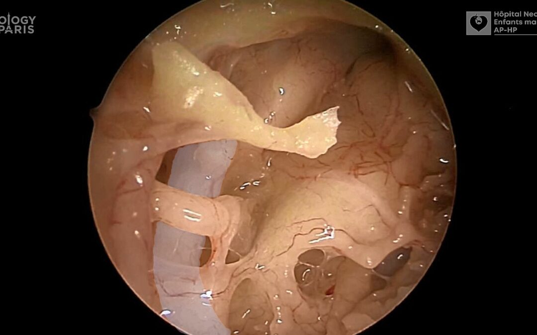 La vidéo permet de mieux retenir l’anatomie chirurgicale