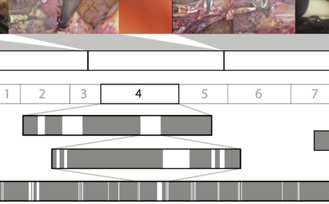 Surgical Video Summarization: Multifarious Uses, Summarization Process and Ad-Hoc Coordination